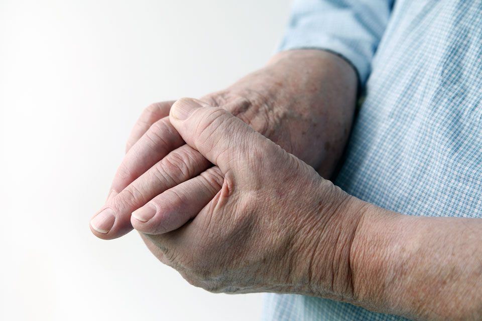 Module 2: Early stages of Rheumatoid Arthritis